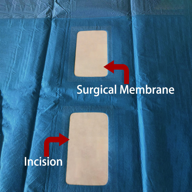 Angiography-Surgical-Drape1